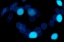 Picture of BLUE BOKEH II