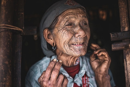 Picture of SMILING CHIN WOMAN