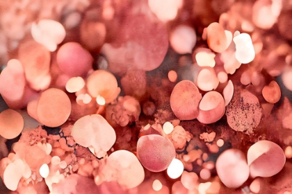 Picture of ROSY SPARKLES