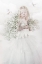 Picture of LITTLE ALBINO GIRL